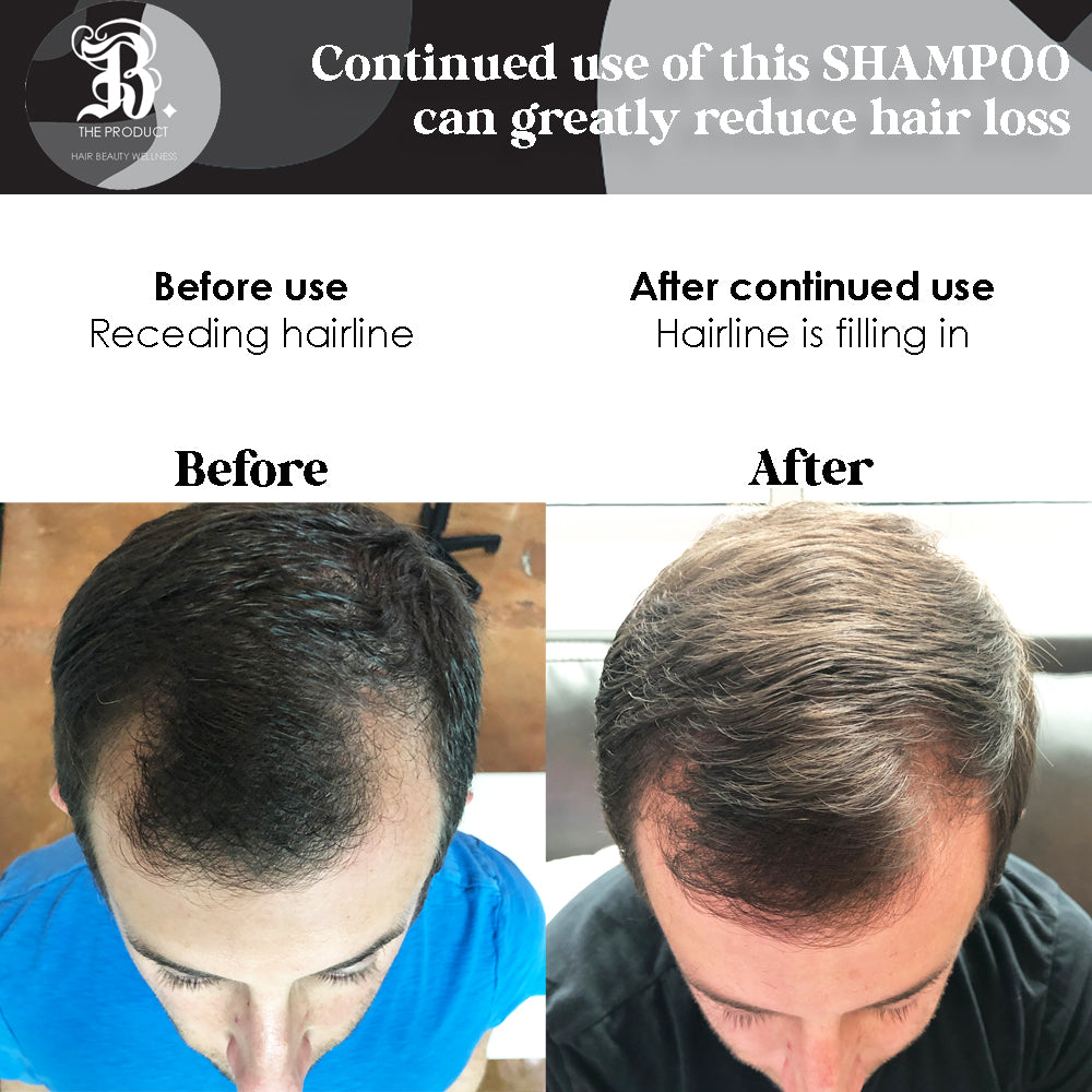 Biotin Shampoo For Hair Growth