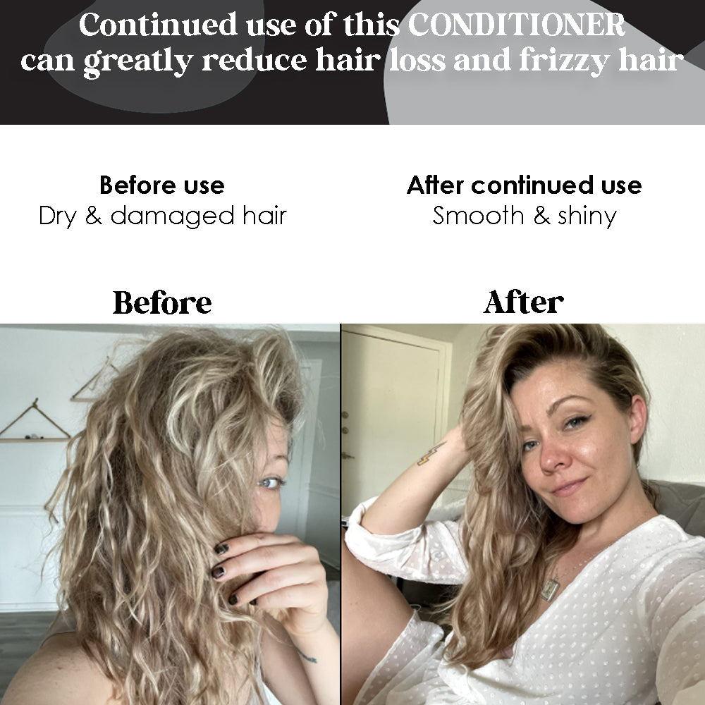 Biotin Conditioner For Hair Growth