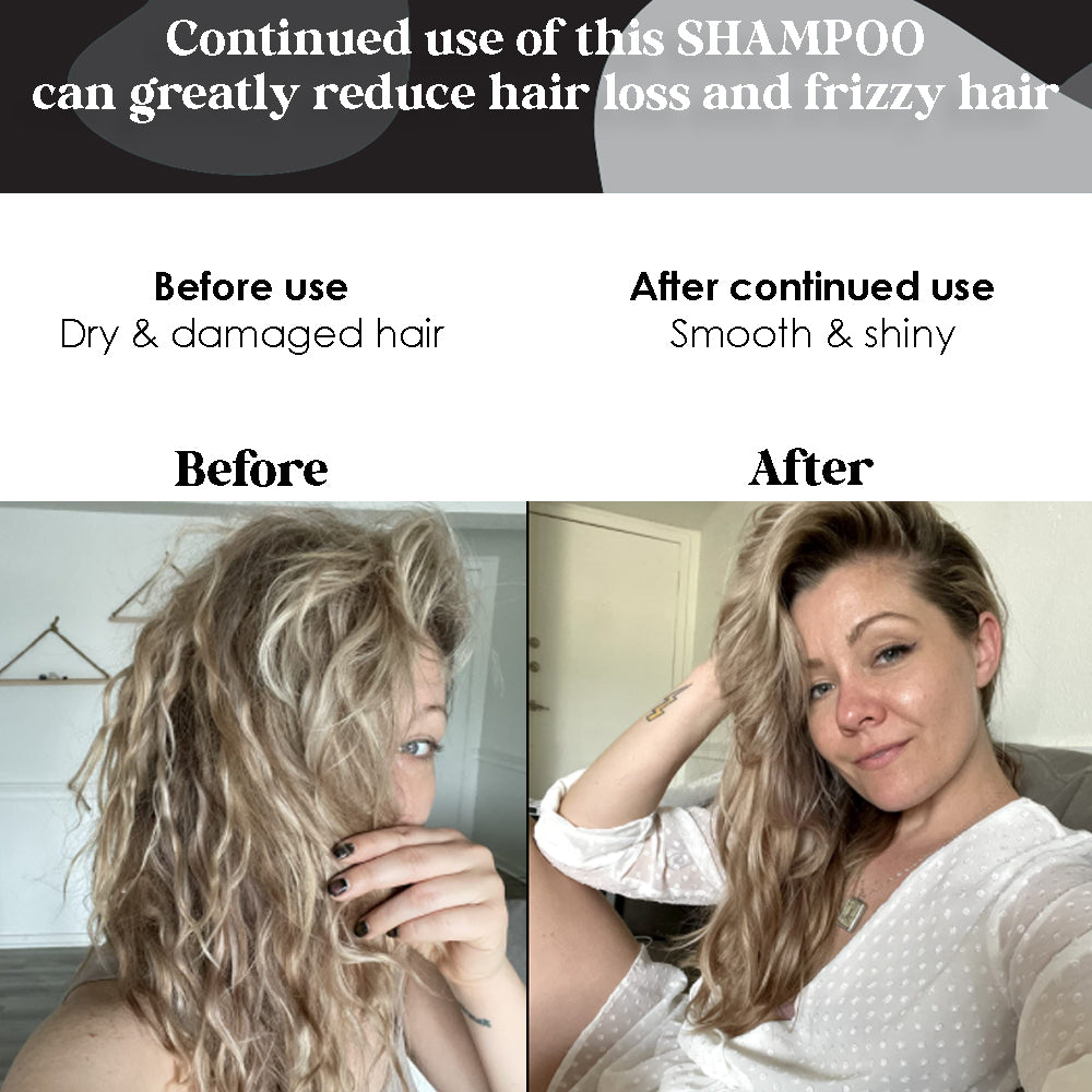Biotin Shampoo For Hair Growth